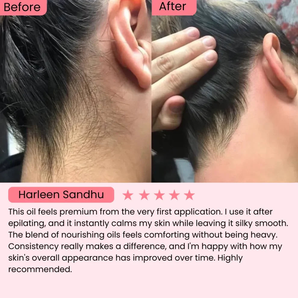 Cyperus Rotundus Hair Reduction Oil